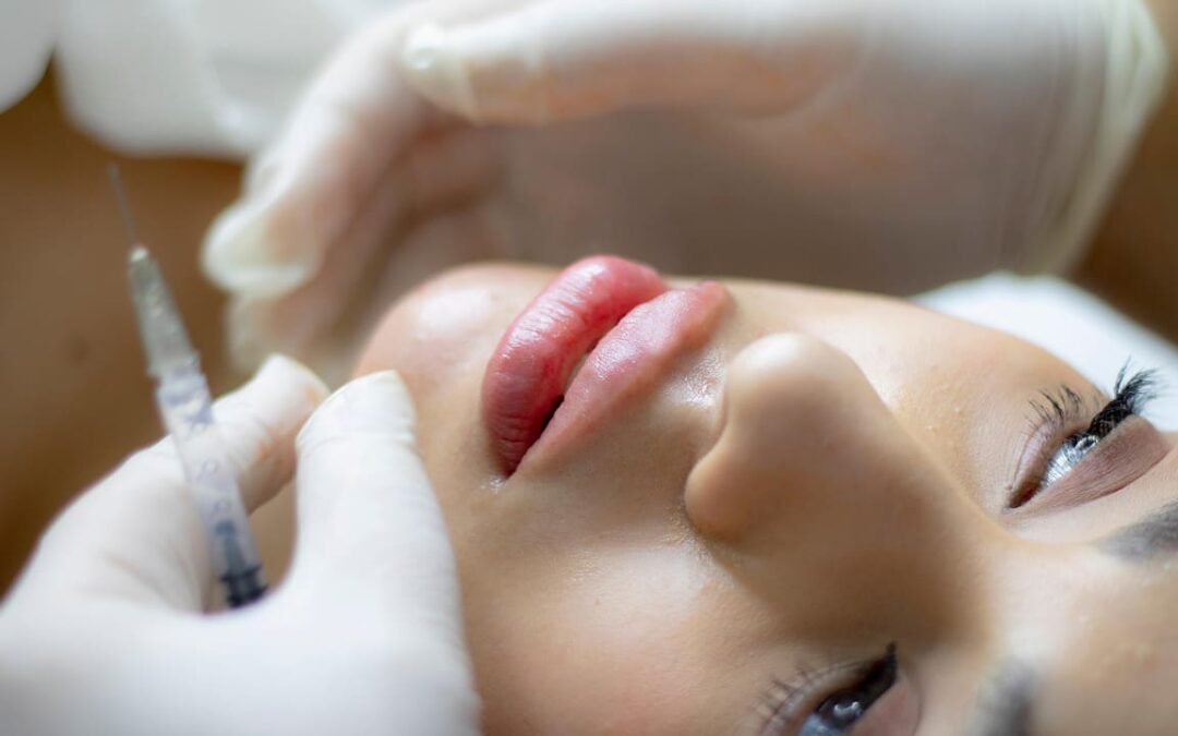 soorten fillers